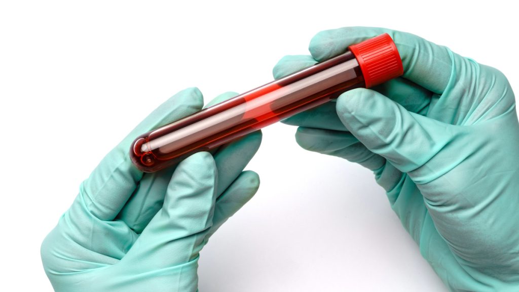 O exame se organiza em três blocos principais. Saiba como cada um contribui para a leitura do hemograma