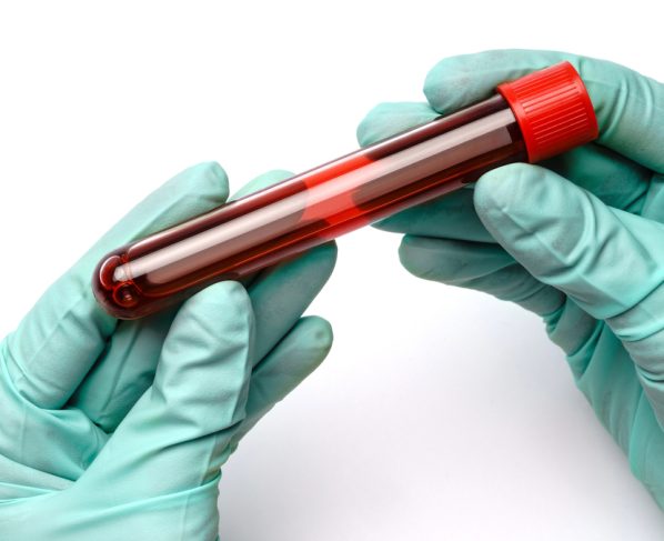 O exame se organiza em três blocos principais. Saiba como cada um contribui para a leitura do hemograma